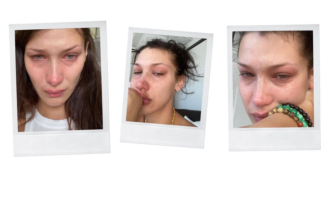 Ansiedad y depresión: La realidad de Bella Hadid es la que sufren miles de jóvenes y es importante que se sepa