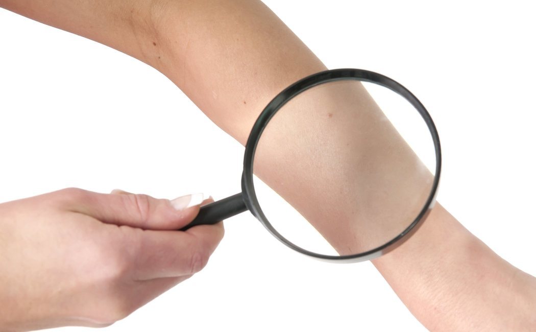 Qué es la dermatopatofobia