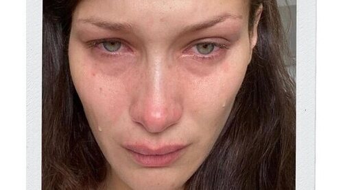 Ansiedad y depresión: La realidad de Bella Hadid es la que sufren miles de jóvenes y es importante que se sepa