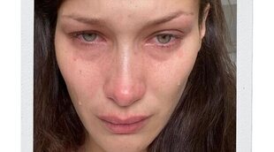 Ansiedad y depresión: La realidad de Bella Hadid es la que sufren miles de jóvenes y es importante que se sepa