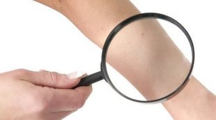 Qué es la dermatopatofobia